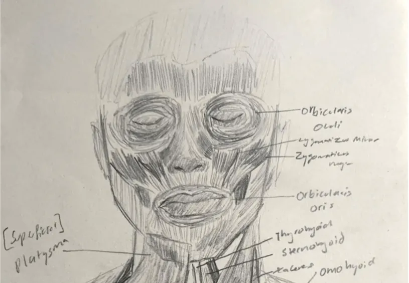 Unweaving the Brachial Plexus
