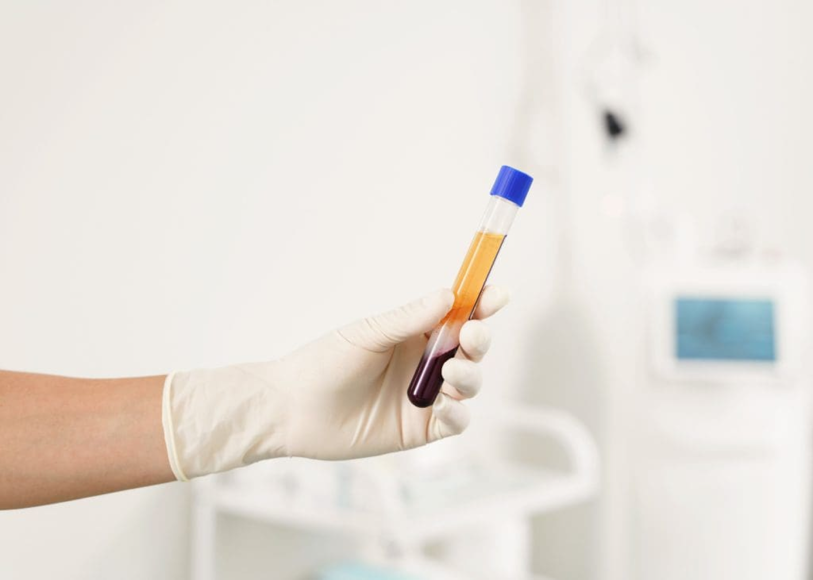 PRP: Platelet Rich Plasma with Powerful Regenerative Properties