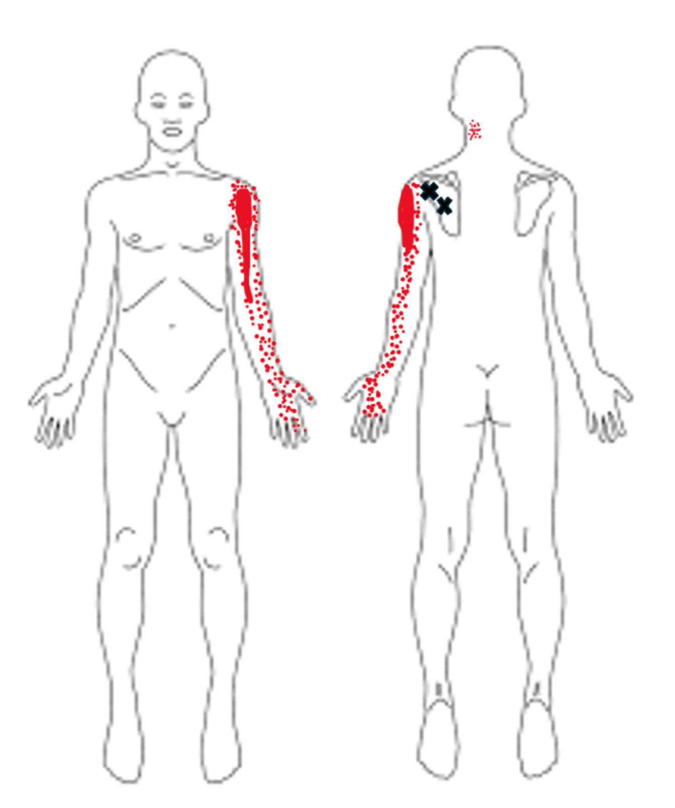A drawing of a person's body