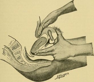 When Is Patient Discomfort Acceptable?