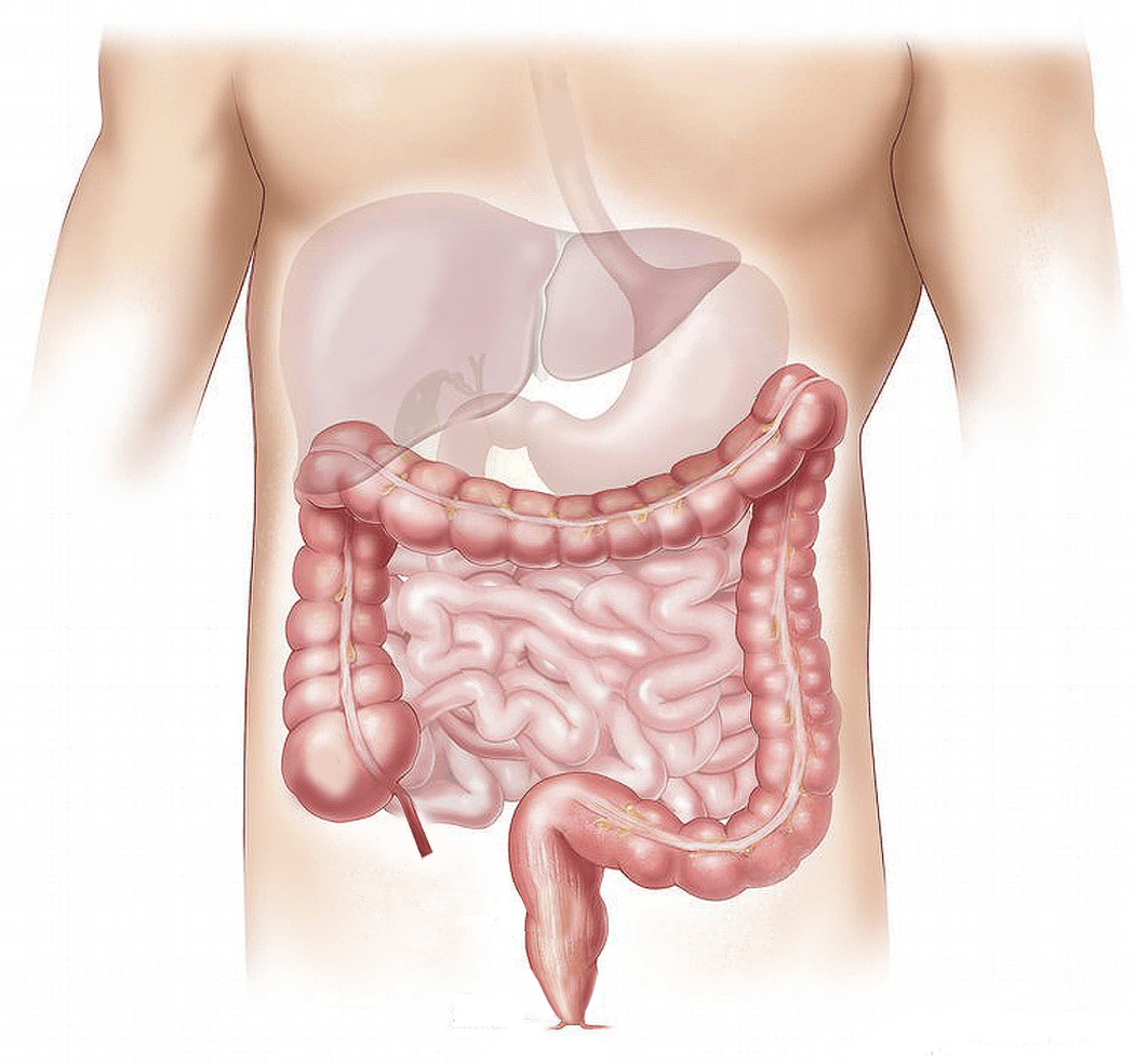 Colorectal Cancer Screening Disparities Among People Experiencing Homelessness