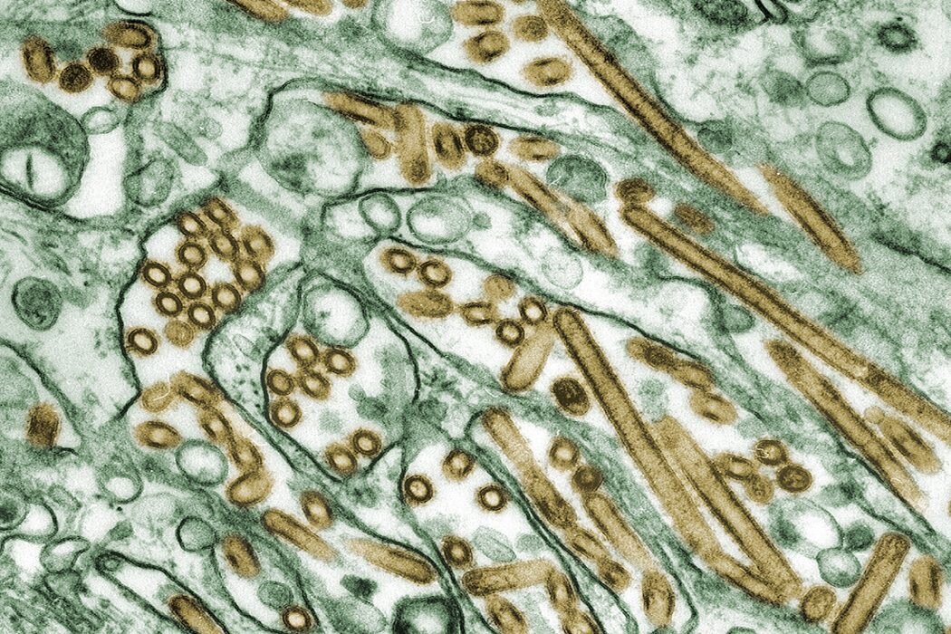 NIH Lifts Funding Moratorium on Gain-of-Function Research for Deadly Pathogens
