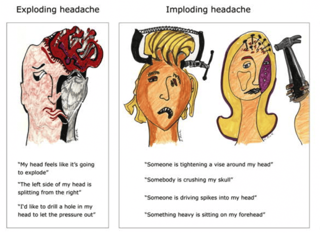 The Ins and Outs of Migraines